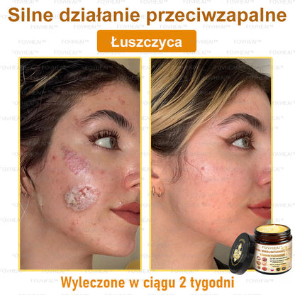 💎🏆FOVHEAl™ Krem wielofunkcyjny z jadem pszczelim - Polecane przez dermatologów – Odpowiednie dla każdego wieku