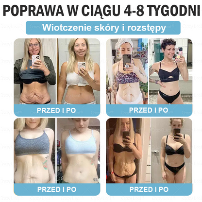 ✨Klinicznie potwierdzone | Oficjalny sklep | CrazyLeaf® Szczupłość i Witalność Tirzepatide – doustny roztwór wspierający odchudzanie, ciśnienie i poziom cukru