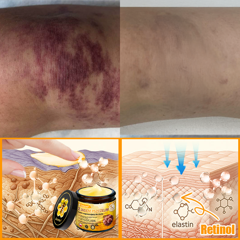 🔥🔥Leurea® Jad Pszczeli Regeneracja Skóry Krem🔥 Naturalna regeneracja skóry, wygładzenie zmarszczek i promienna cera-50 ml