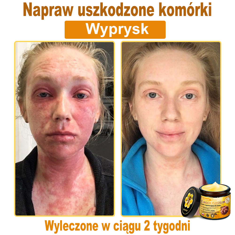 🔥🔥Leurea® Jad Pszczeli Regeneracja Skóry Krem🔥 Naturalna regeneracja skóry, wygładzenie zmarszczek i promienna cera-50 ml