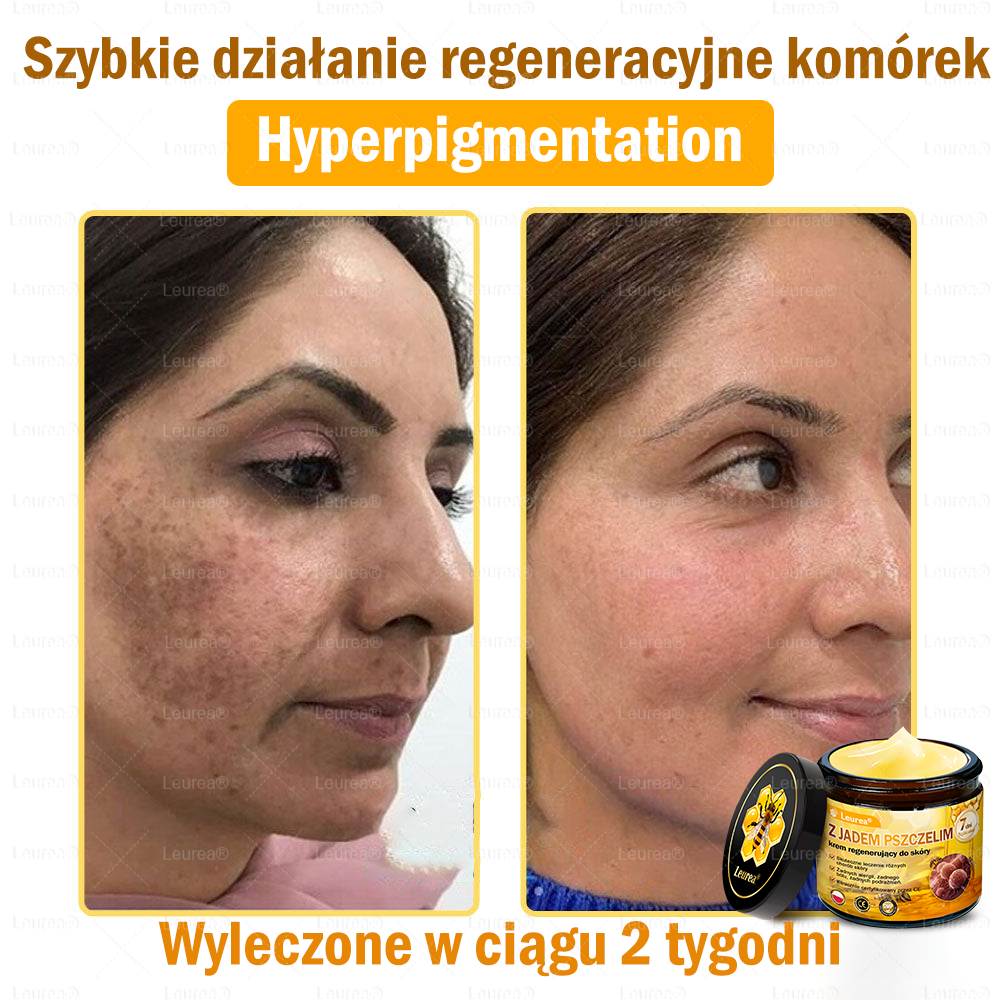 🔥🔥Leurea® Jad Pszczeli Regeneracja Skóry Krem🔥 Naturalna regeneracja skóry, wygładzenie zmarszczek i promienna cera-50 ml