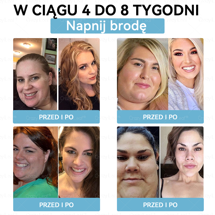 ✨Klinicznie potwierdzone | Oficjalny sklep | CrazyLeaf® Szczupłość i Witalność Tirzepatide – doustny roztwór wspierający odchudzanie, ciśnienie i poziom cukru