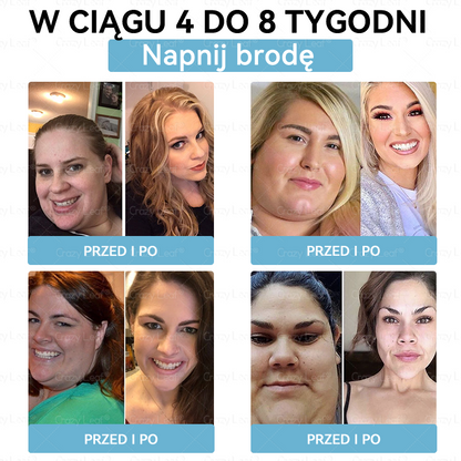 ✨Klinicznie potwierdzone | Oficjalny sklep | CrazyLeaf® Szczupłość i Witalność Tirzepatide – doustny roztwór wspierający odchudzanie, ciśnienie i poziom cukru