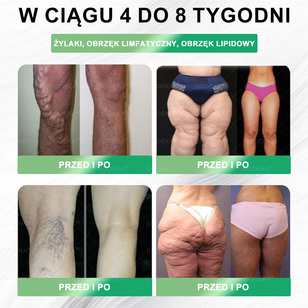 🧑‍⚕️ 💟💟 DOOEKA® GLP-1 8 w 1 Fit & Vital roztwór doustny – Raz dziennie, widoczne zmiany w ciągu 7 dni / W przypadku otyłości, zdrowia serca i układu krążenia, cukrzycy, bezdechu sennego, zdrowia jelit, problemów ze stawami i wielu innych