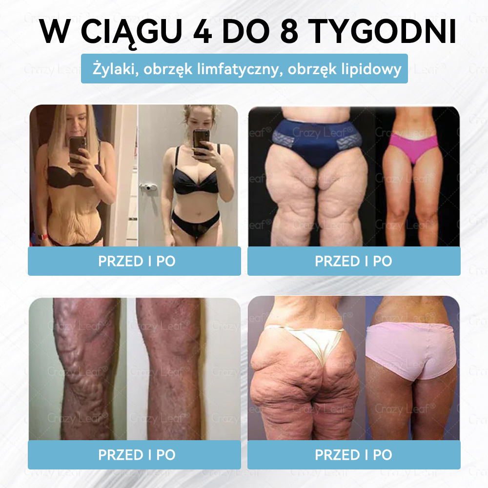 ✨Klinicznie potwierdzone | Oficjalny sklep | CrazyLeaf® Szczupłość i Witalność Tirzepatide – doustny roztwór wspierający odchudzanie, ciśnienie i poziom cukru