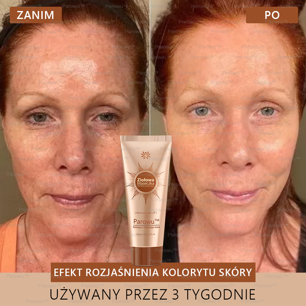 ✨Parowu™ Wybielająca i Rozjaśniająca Maska - Naturalne składniki trwale usuwają plamy, piegi i przebarwienia🔥🔥🔥