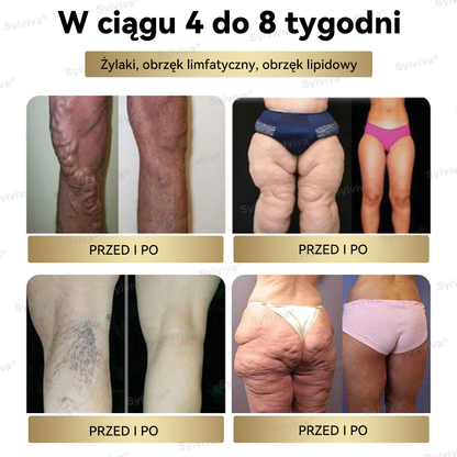 🔥 Polecane przez Klinikę Mayo | Oficjalny sklep | Sylviva®✅ GLP-1 Moringa – krople na odchudzanie i zdrowie 🔥 (Spalacz tłuszczu o jakości spożywczej – opracowany przez Towarzystwo Otyłości🔥