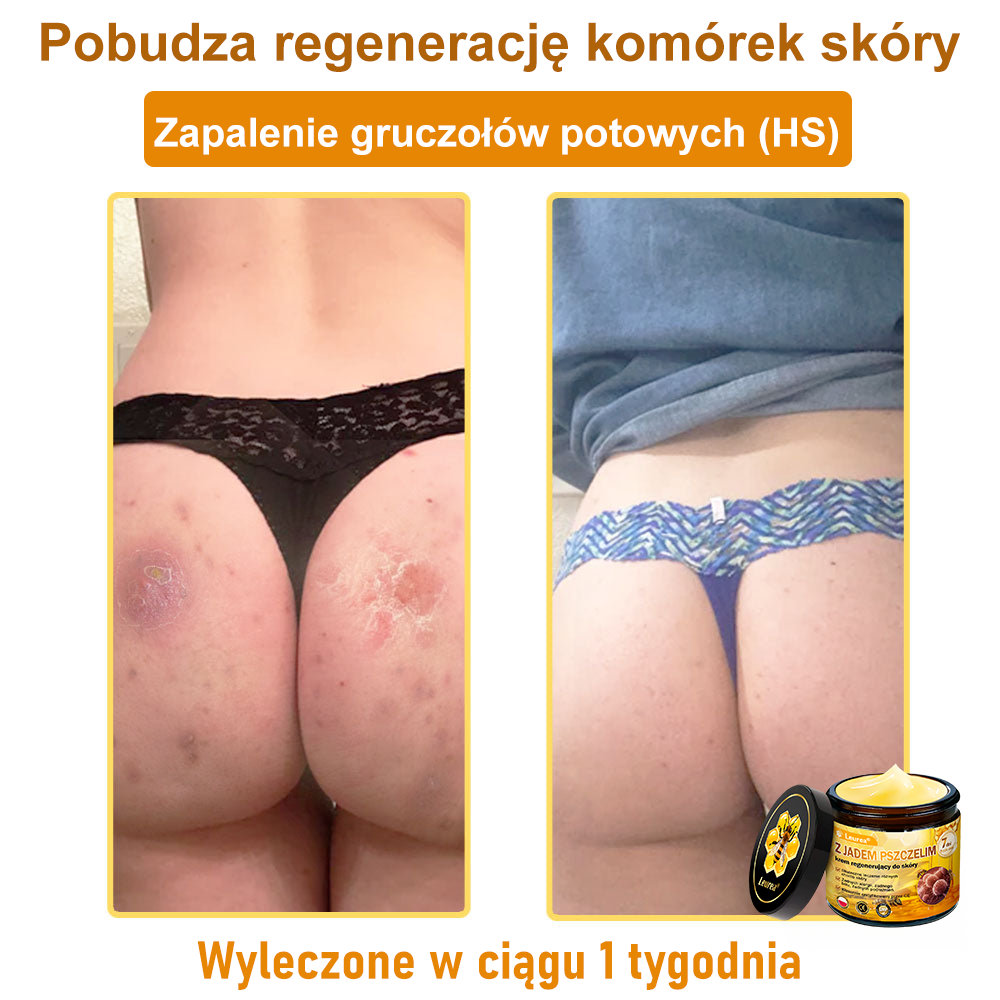 🔥🔥Leurea® Jad Pszczeli Regeneracja Skóry Krem🔥 Naturalna regeneracja skóry, wygładzenie zmarszczek i promienna cera-50 ml